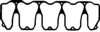 WILMINK GROUP WG1086262 Gasket, cylinder head cover